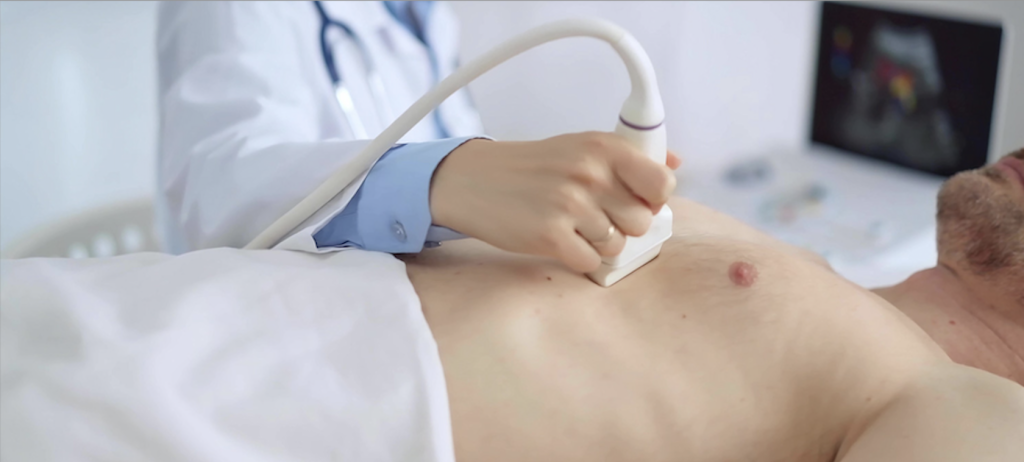 Echographie cardiaque